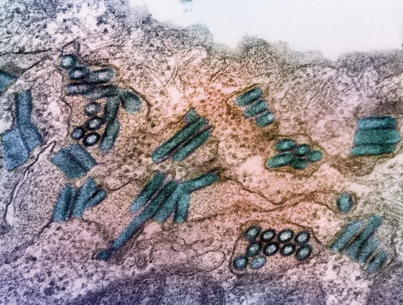L'epidemia di Ebola in Congo è iniziata prima del dichiarato, afferma l'OMS