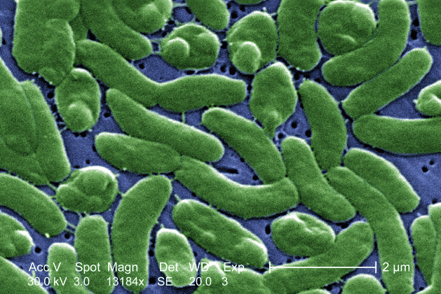 Louisiana alerta banhistas devido ao aumento de infecções por bactéria devoradora de carne