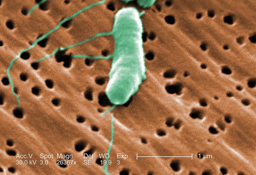 Louisiana alerta banhistas devido ao aumento de infecções por bactéria devoradora de carne